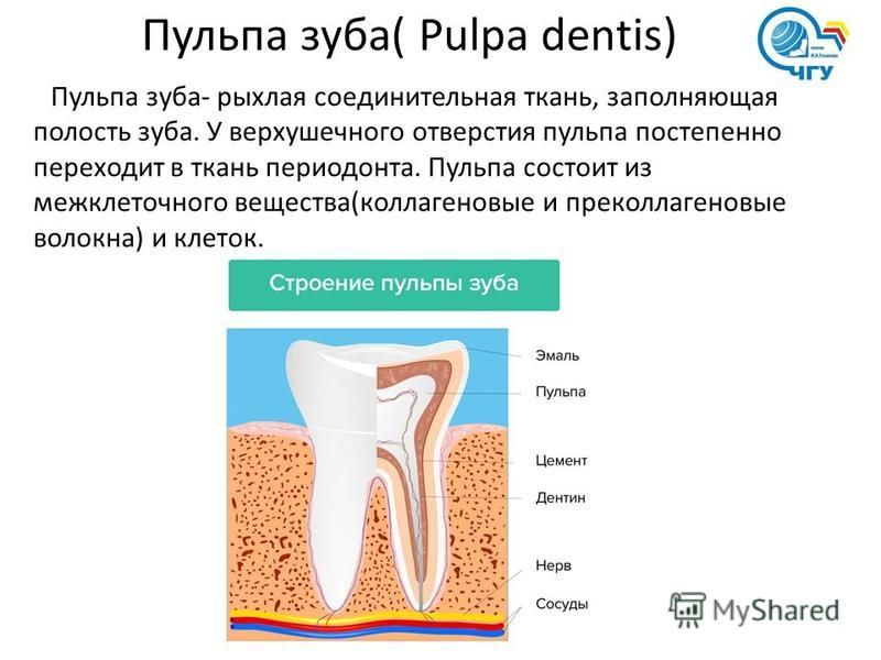 Что такое пульпа в зубе