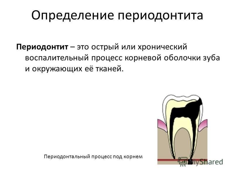 Осложнение лечения периодонтита. Апикальный периодонтит зуба 2.4. Причины развития хронического периодонтита.