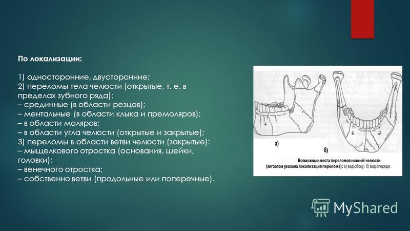 Ушиб верхней губы карта вызова