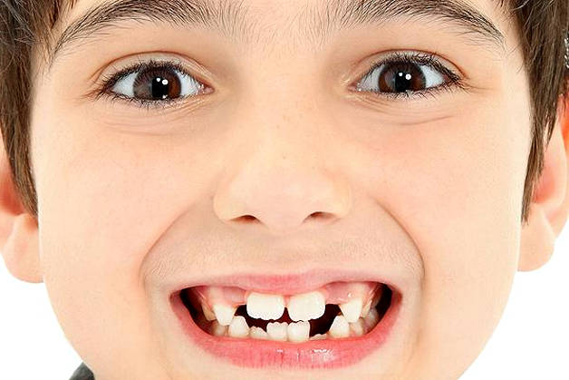 Сроки прорезывания коренных зубов