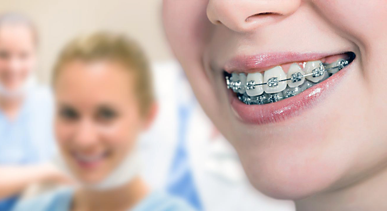 Brackets are used. Стоматология брекеты. Ортодонтия брекеты. Стоматология ортодонт. Стоматология брекеты улыбка.