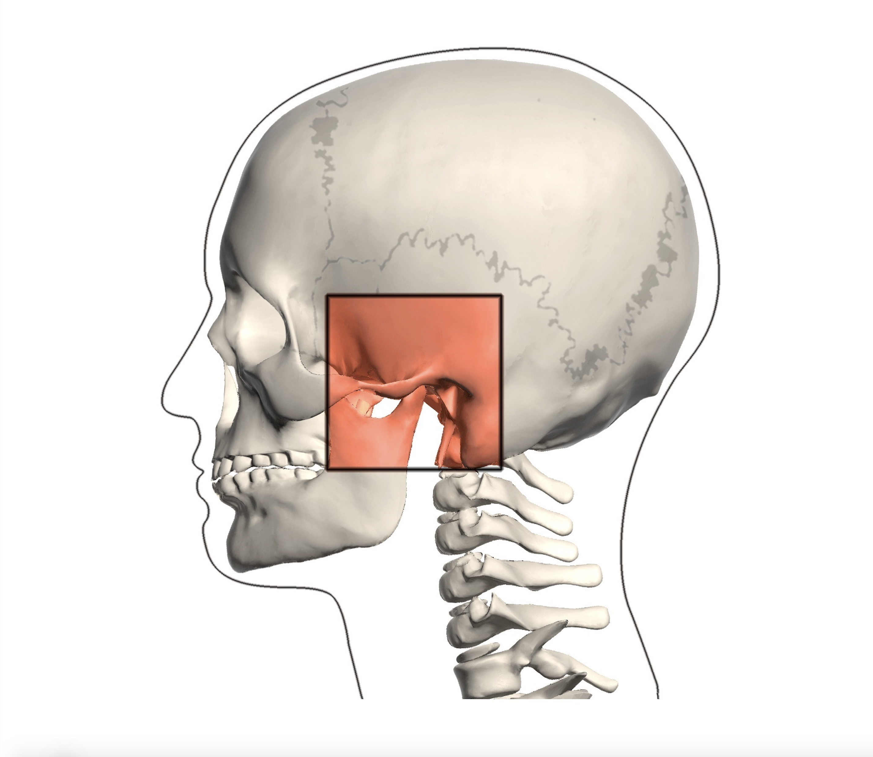 Боль в челюсти. Артроз височно челюстного сустава. Остеоартроз височно-нижнечелюстного сустава.