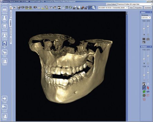 3D-изображение челюсти