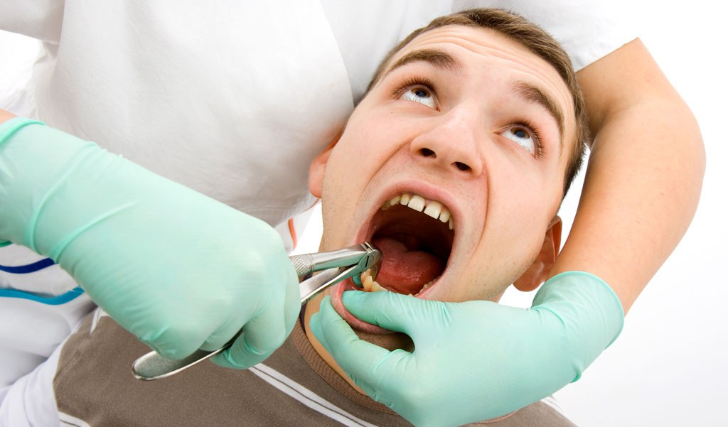 Удаление зуба может стать причиной онемения