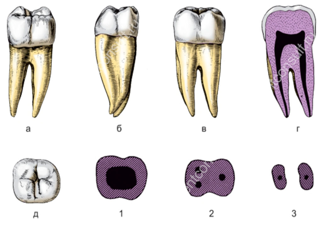 Зуб 1.4. Зуб второй моляр нижней челюсти. Второй моляр нижней челюсти анатомия. Второй Нижний моляр анатомия. Анатомия зуба моляра нижней челюсти.