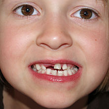 Deciduous teeth by David Shankbone.jpg