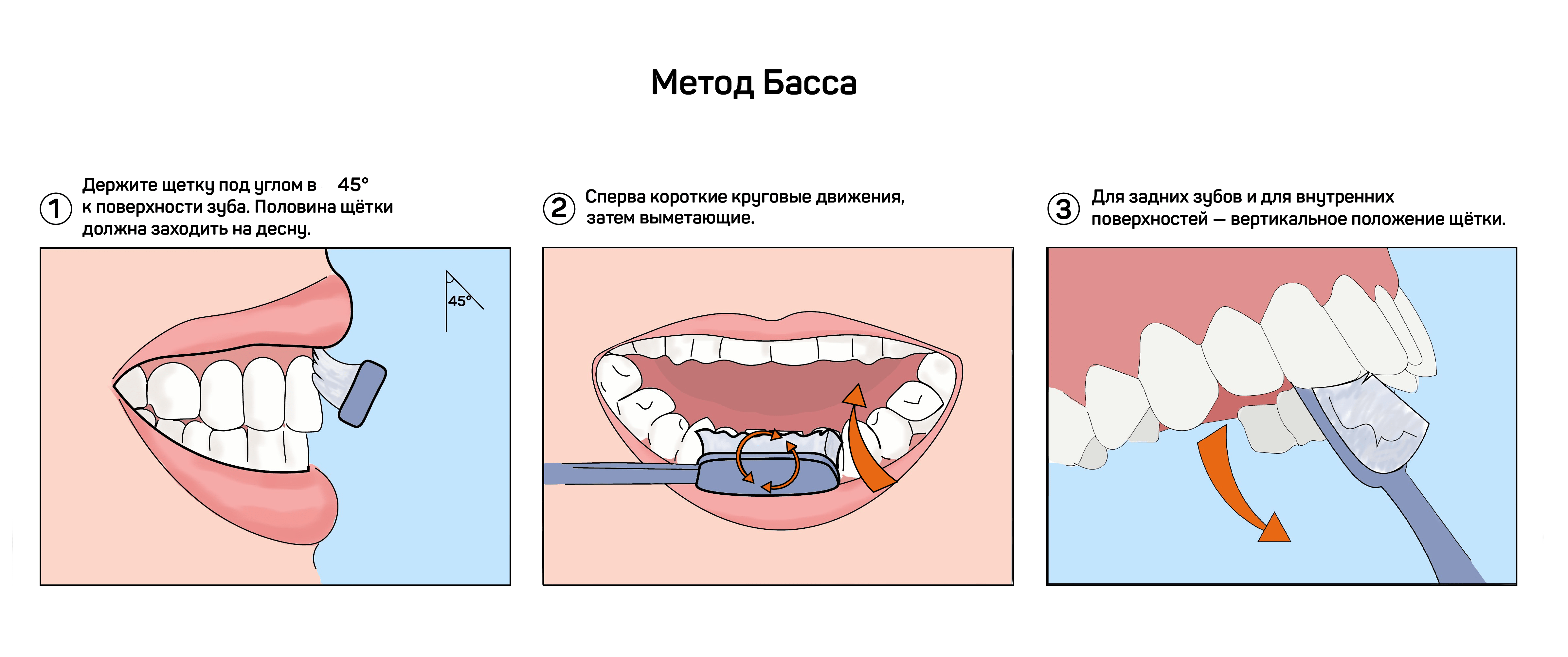 Метод чистки зубов метод Леонарда. Метод басс чистки зубов. Метод чистки басса. Метод Фонеса чистки зубов.