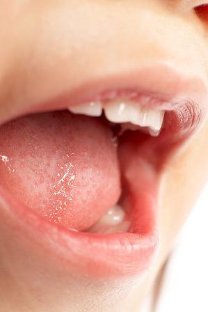 профилактика заболеваний полости рта