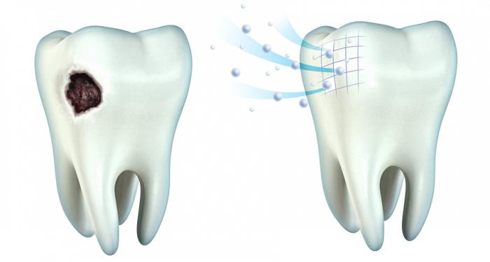 реминерализация зубов