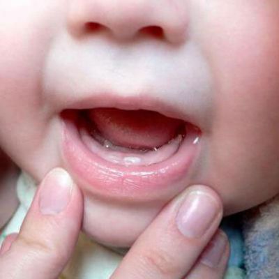 У ребенка растут зубы