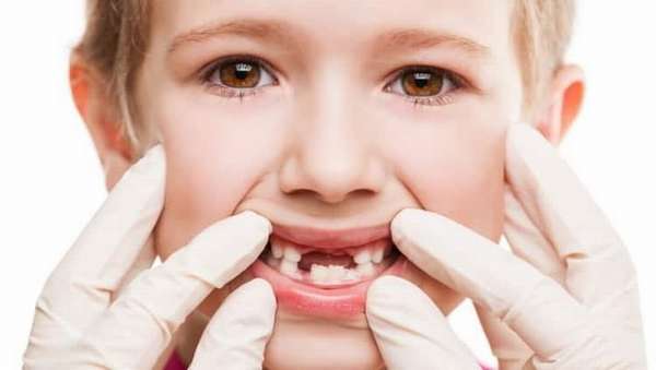 какие зубы выпадают у детей