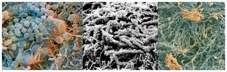 Бактерии гибнут от. Кариес под микроскопом бактерии. Налет Пристли под микроскопом. Зубной налет под микроскопом. Бактерии зубного налета под микроскопом.