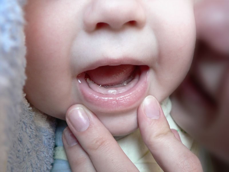 Появление зубов у ребенка