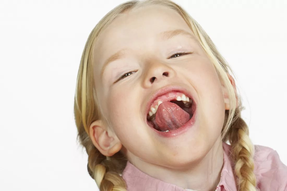 Ребенок сглатывает слюну. Девочка открыла рот. Девочки с открытыми ртами. Дети с открытым ртом. Девочка с открытым ртом.