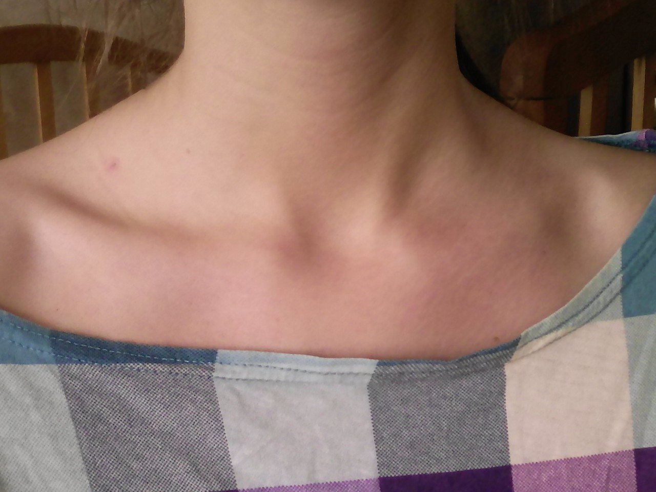воспаление лимфоузлов на груди у женщин фото 33