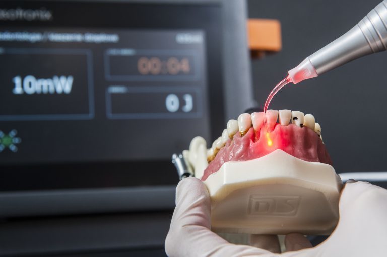 Лазеротерапия в стоматологии презентация