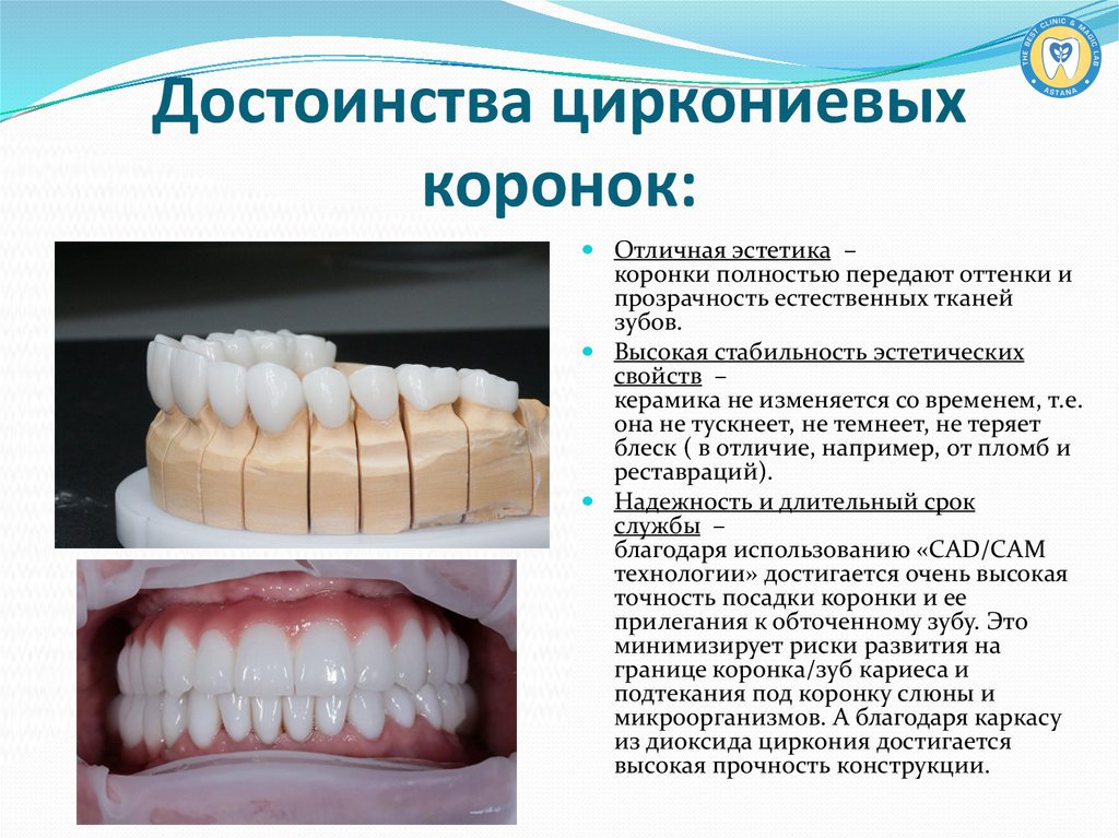 Циркониевые коронки для зубов преимущества и недостатки фото
