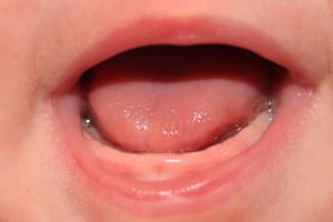 Обзор лучших гелей для десен при прорезывании зубов у грудничков с 3-4 месяцев: рейтинг обезболивающих средств