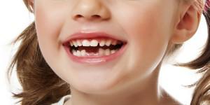 Когда начинают выпадать зубы у детей: схема, сроки и порядок смены молочных единиц на постоянные с таблицей