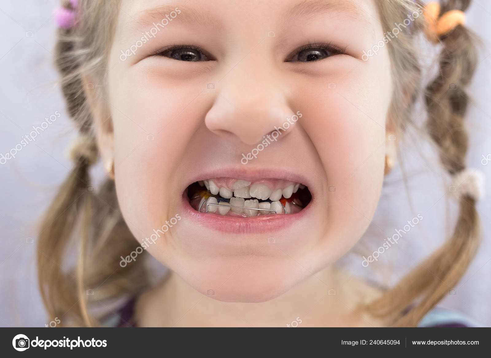 Детские зубы с каресо м