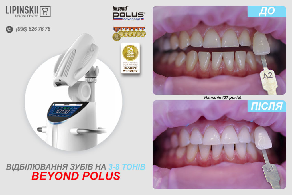 Beyond polus