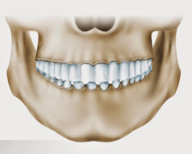 5 фактов о глубоком прикусе, которые заставят не откладывать визит к ортодонту