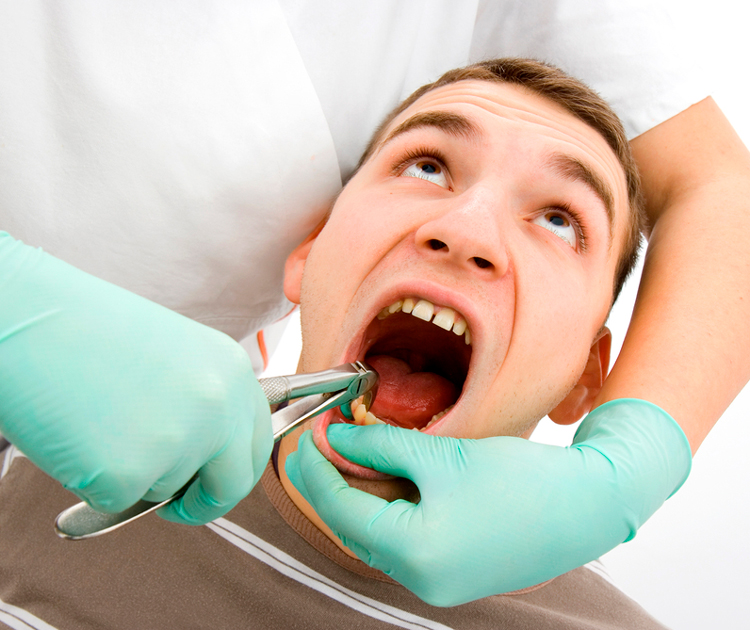 10 вопросов после удаления зуба, на которые важно знать ответы
