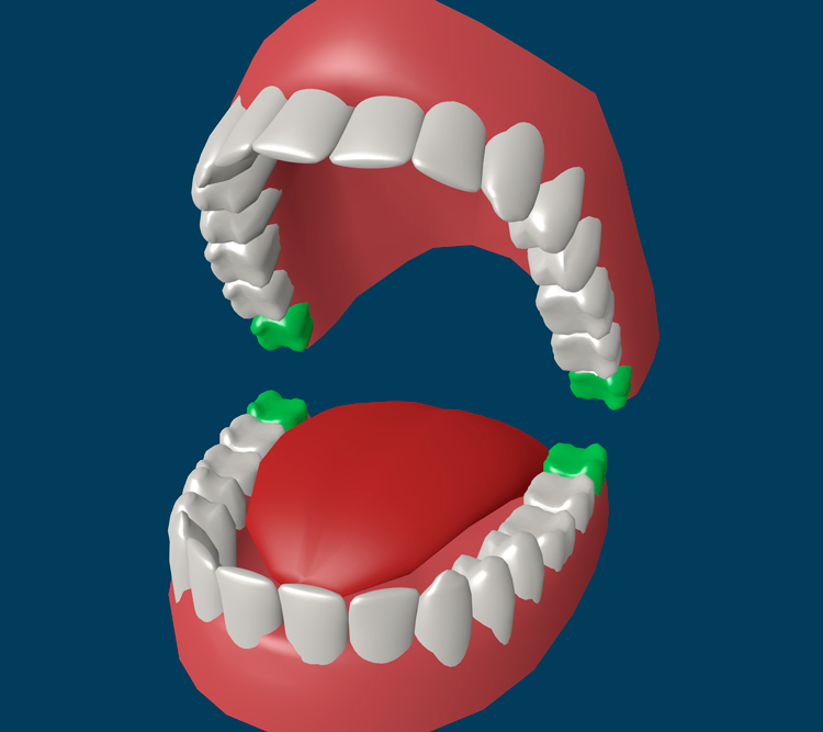 7 интересных фактов про зубы «восьмерки»