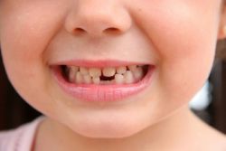 какие зубы выпадают у детей