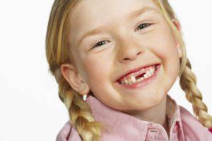 Как и где удалить молочный зуб у ребенка если он шатается?