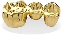 Gold Dental Bridge