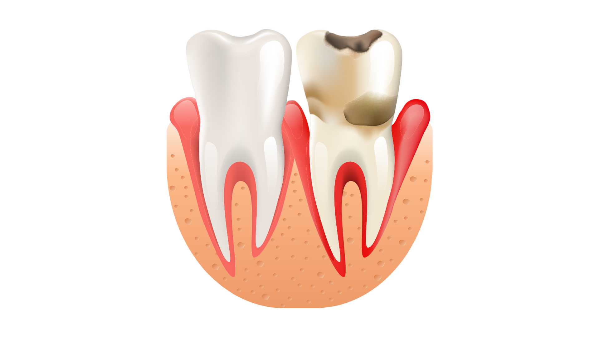 Как отличить зубную боль от воспаления