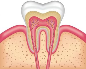 teeth root canal image