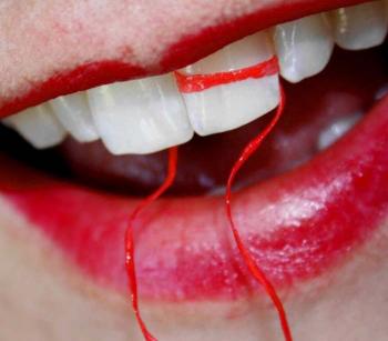 Как выдернуть зуб без боли в домашних условиях