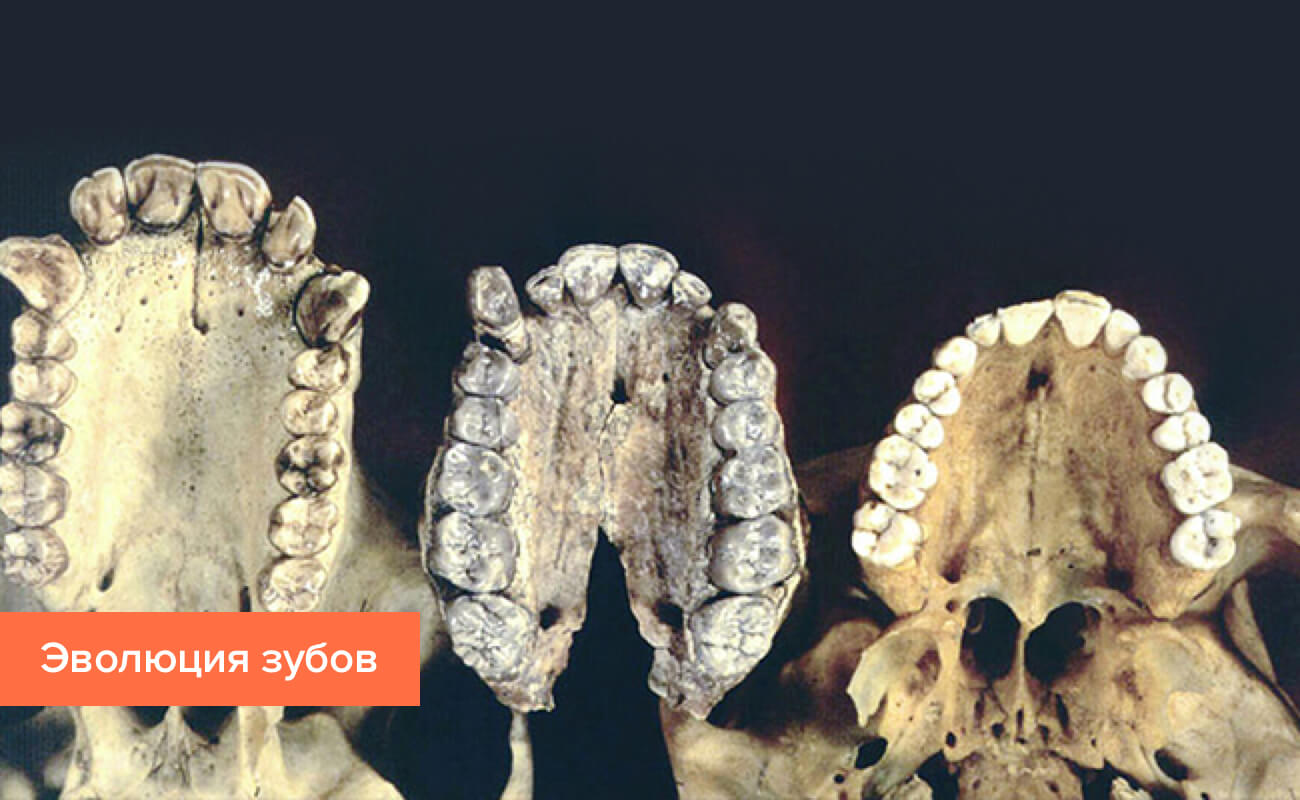 Фото зубов на разных этапах эволюции