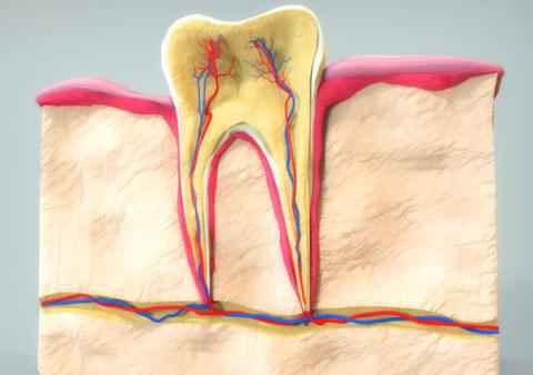 как убить нерв в зубе 