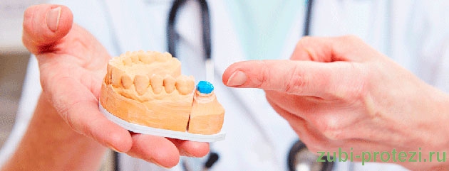 причины зубной боли под коронкой