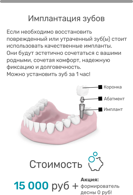 Можно ли с имплантами. Постановка имплантов зубов. Стоматология расценки на протезирование зубов. Расценки на имплантация зубов. Сколько стоит вставить имплант зуба.