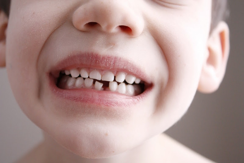 Сколько зубов должно быть у ребенка в 3 года