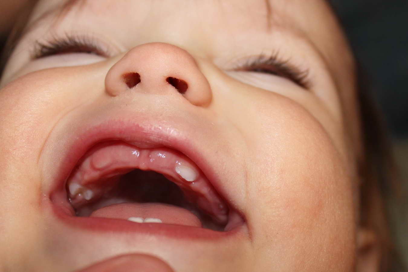 Сколько зубов должно быть у ребенка в 3 года