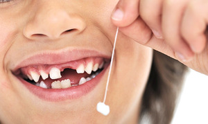 Как легко удалить молочный зуб у ребенка