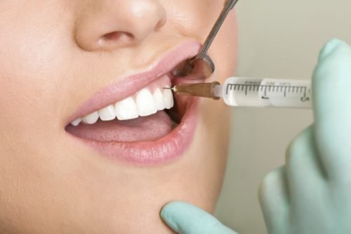 Инъекционное обезболивание зубов